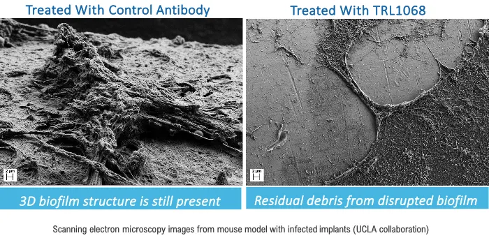 TRL1068BiofilmReduction